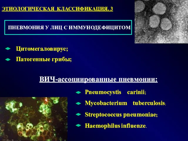 Цитомегаловирус; Патогенные грибы; ВИЧ-ассоциированные пневмонии: Pneumocystis carinii; Mycobacterium tuberculosis; Streptococcus pneumoniae; Haemophilus influenze. ЭТИОЛОГИЧЕСКАЯ КЛАССИФИКАЦИЯ. 3