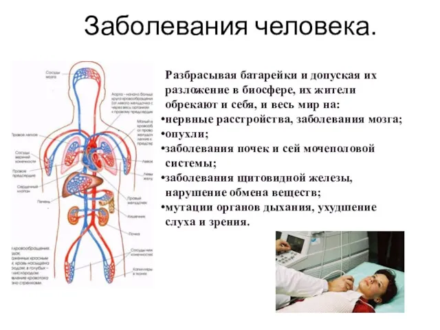 Заболевания человека. Разбрасывая батарейки и допуская их разложение в биосфере,