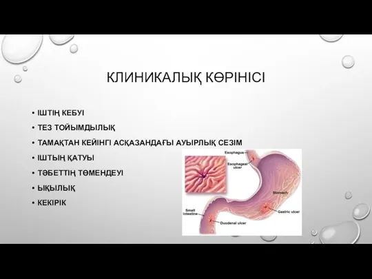 КЛИНИКАЛЫҚ КӨРІНІСІ ІШТІҢ КЕБУІ ТЕЗ ТОЙЫМДЫЛЫҚ ТАМАҚТАН КЕЙІНГІ АСҚАЗАНДАҒЫ АУЫРЛЫҚ