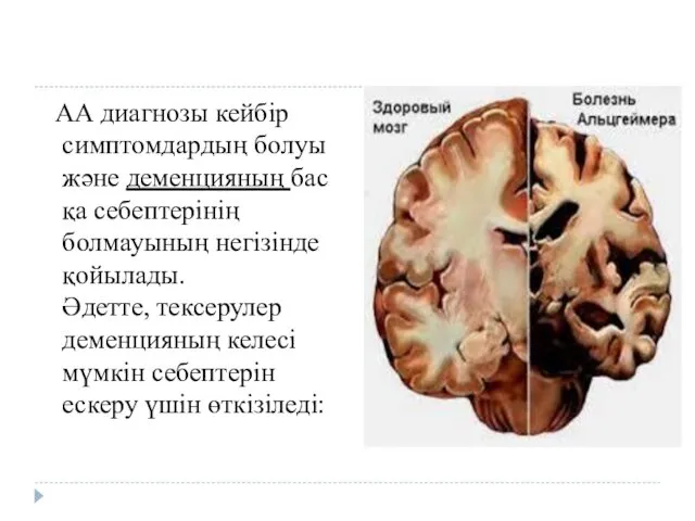 АА диагнозы кейбір симптомдардың болуы және деменцияның басқа себептерінің болмауының