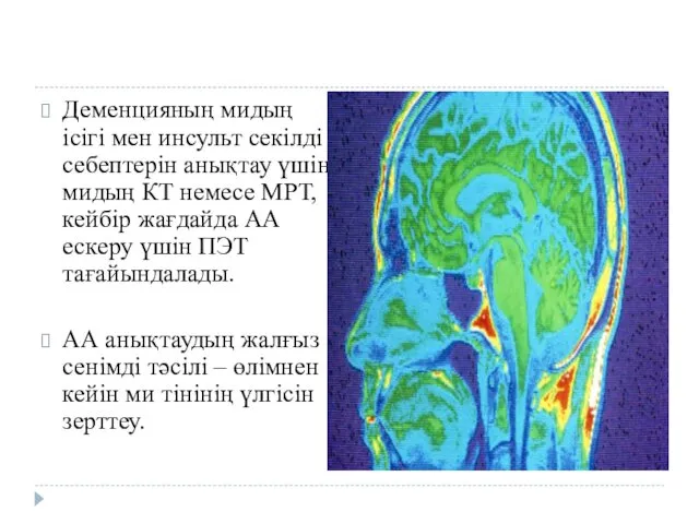 Деменцияның мидың ісігі мен инсульт секілді себептерін анықтау үшін мидың