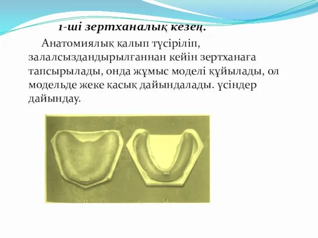 1-ші зертханалық кезең. Анатомиялық қалып түсіріліп, залалсыздандырылғаннан кейін зертханаға тапсырылады,