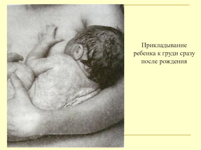 Прикладывание ребенка к груди сразу после рождения