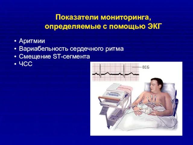 Аритмии Вариабельность сердечного ритма Смещение ST-сегмента ЧСС Показатели мониторинга, определяемые с помощью ЭКГ