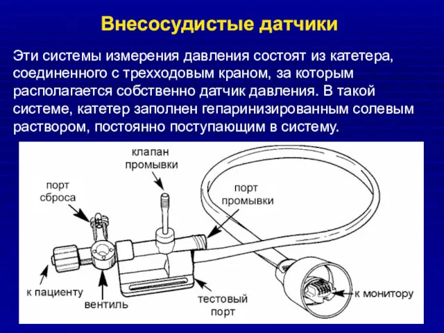 Эти системы измерения давления состоят из катетера, соединенного с трехходовым