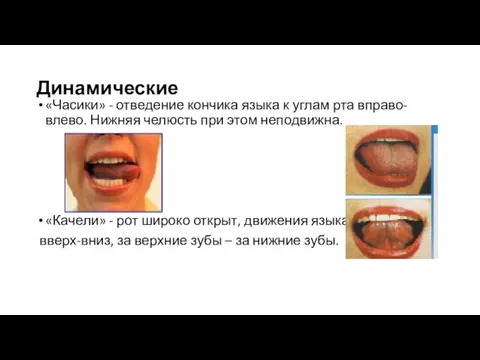 Динамические «Часики» - отведение кончика языка к углам рта вправо-влево. Нижняя челюсть при