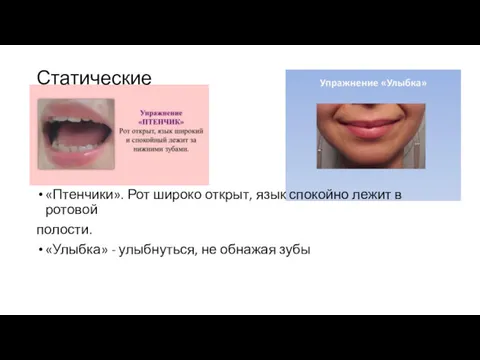 «Птенчики». Рот широко открыт, язык спокойно лежит в ротовой полости. «Улыбка» - улыбнуться,