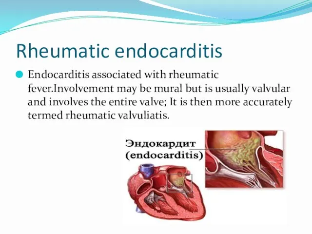 Rheumatic endocarditis Endocarditis associated with rheumatic fever.Involvement may be mural