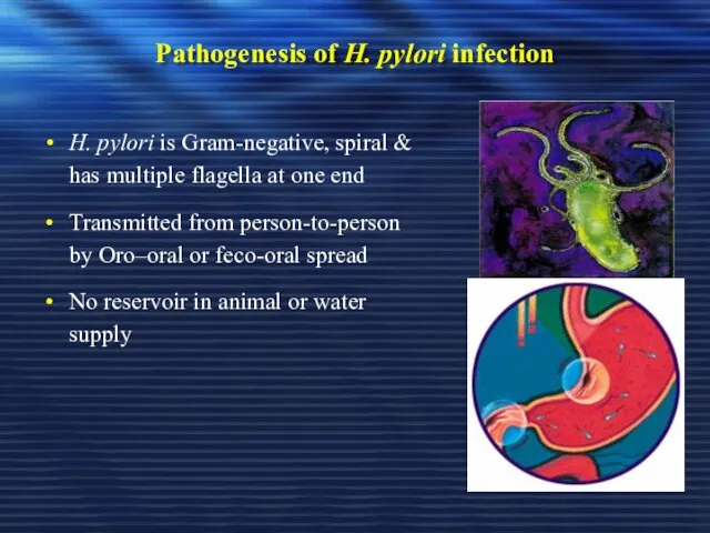 Pathogenesis of H. pylori infection H. pylori is Gram-negative, spiral & has multiple
