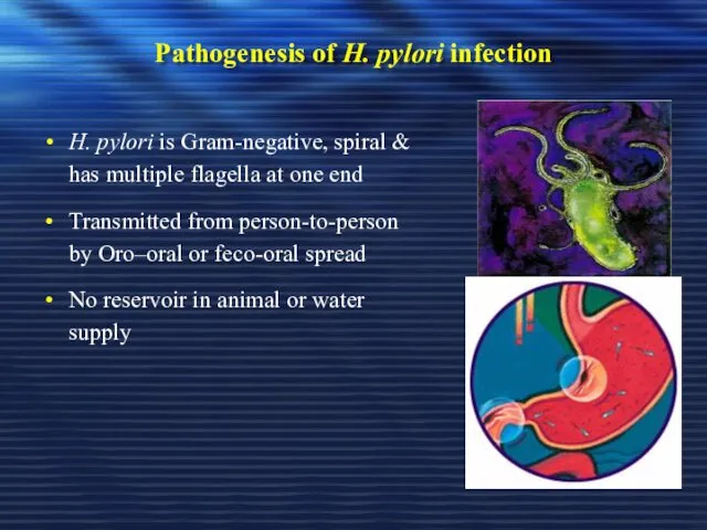 Pathogenesis of H. pylori infection H. pylori is Gram-negative, spiral