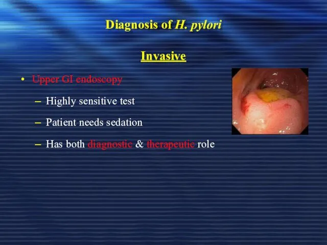 Diagnosis of H. pylori Invasive Upper GI endoscopy Highly sensitive test Patient needs