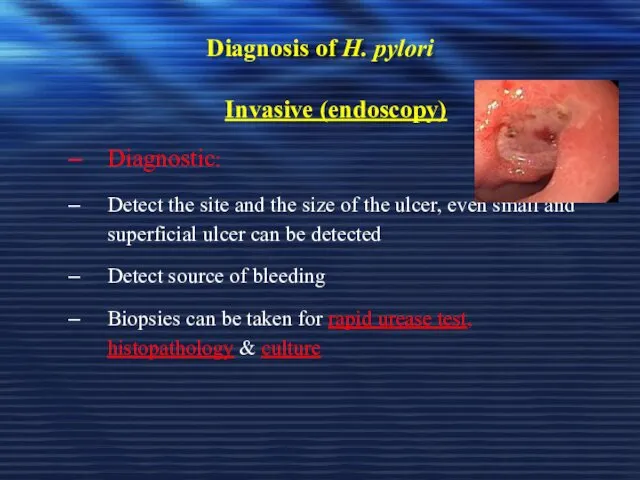 Diagnosis of H. pylori Invasive (endoscopy) Diagnostic: Detect the site and the size
