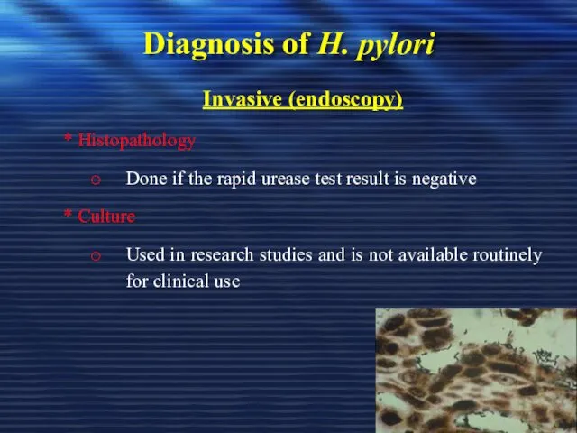 Diagnosis of H. pylori Invasive (endoscopy) * Histopathology Done if the rapid urease
