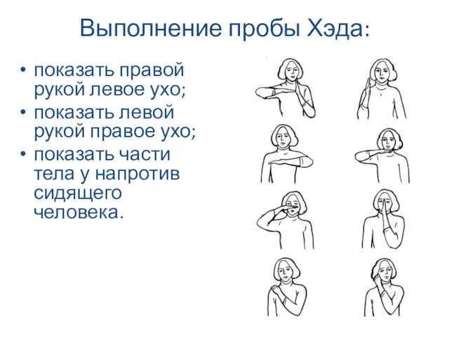 Выполнение пробы Хэда: показать правой рукой левое ухо; показать левой