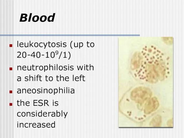 Blood leukocytosis (up to 20-40-109/1) neutrophilosis with a shift to