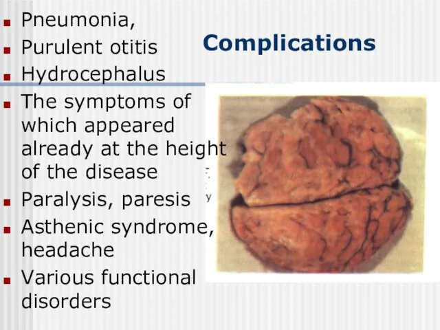 Complications Pneumonia, Purulent otitis Hydrocephalus The symptoms of which appeared