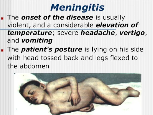 Meningitis The onset of the disease is usually violent, and