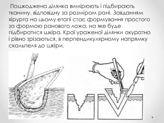 Пошкоджена ділянка вимірюють і підбирають тканину, відповідну за розміром рані.