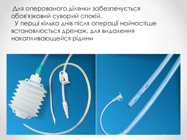 Для оперованого ділянки забезпечується обов'язковий суворий спокій. У перші кілька