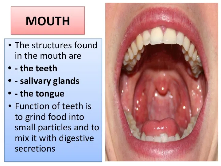 MOUTH The structures found in the mouth are - the
