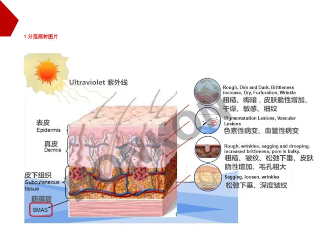 1.分层照射图片