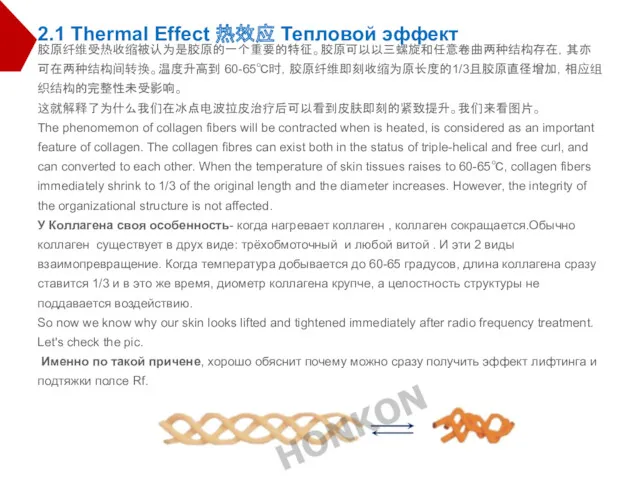 胶原纤维受热收缩被认为是胶原的一个重要的特征。胶原可以以三螺旋和任意卷曲两种结构存在，其亦可在两种结构间转换。温度升高到 60-65℃时，胶原纤维即刻收缩为原长度的1/3且胶原直径增加，相应组织结构的完整性未受影响。 这就解释了为什么我们在冰点电波拉皮治疗后可以看到皮肤即刻的紧致提升。我们来看图片。 The phenomemon of collagen fibers will be