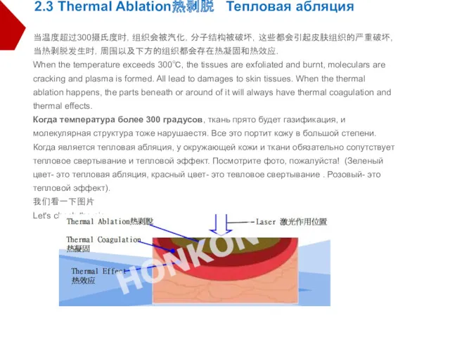 2.3 Thermal Ablation热剥脱 Тепловая абляция 当温度超过300摄氏度时，组织会被汽化，分子结构被破坏，这些都会引起皮肤组织的严重破坏, 当热剥脱发生时，周围以及下方的组织都会存在热凝固和热效应. When the temperature