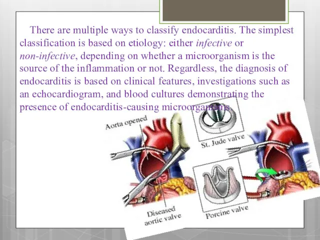 There are multiple ways to classify endocarditis. The simplest classification is based on