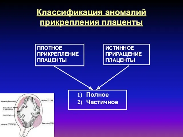 Классификация аномалий прикрепления плаценты ПЛОТНОЕ ПРИКРЕПЛЕНИЕ ПЛАЦЕНТЫ ИСТИННОЕ ПРИРАЩЕНИЕ ПЛАЦЕНТЫ Полное Частичное