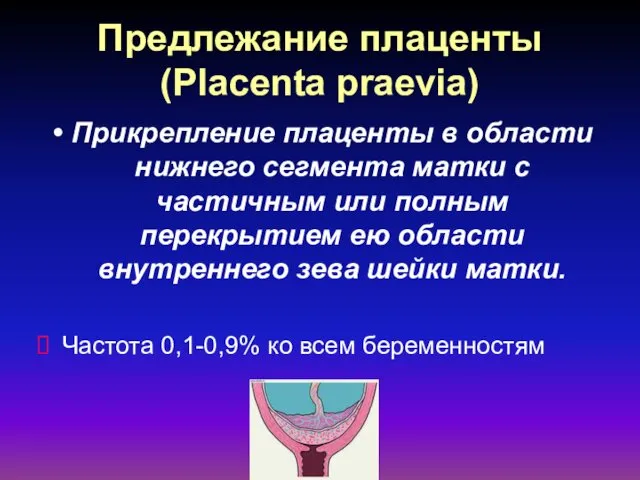 Предлежание плаценты (Placenta praevia) Прикрепление плаценты в области нижнего сегмента