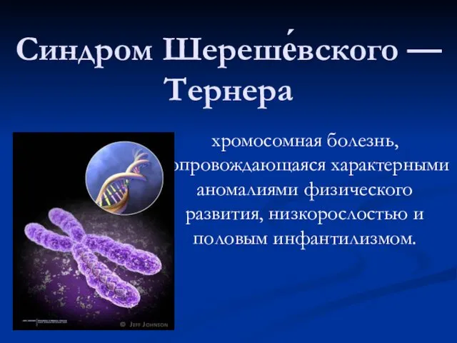 Синдром Шереше́вского — Тернера хромосомная болезнь, сопровождающаяся характерными аномалиями физического развития, низкорослостью и половым инфантилизмом.