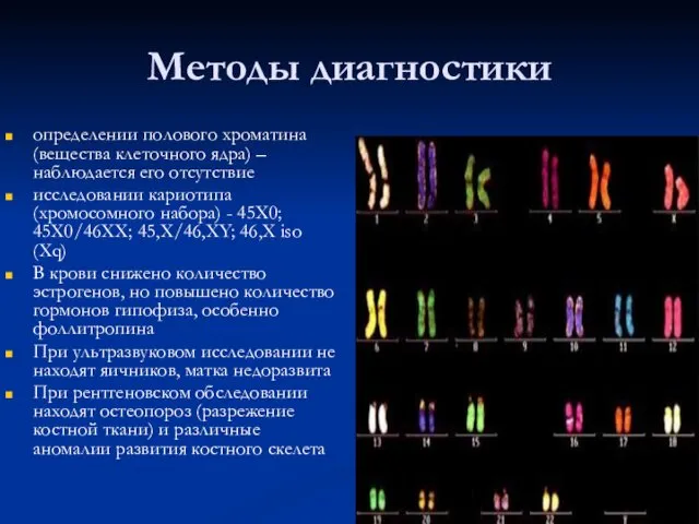 Методы диагностики определении полового хроматина (вещества клеточного ядра) – наблюдается