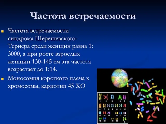 Частота встречаемости Частота встречаемости синдрома Шерешевского-Тернера среди женщин равна 1: