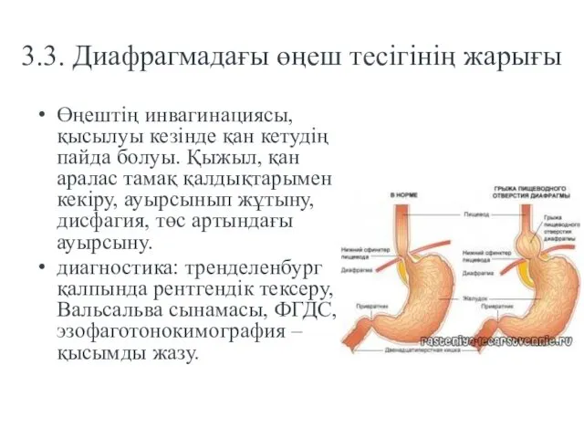 3.3. Диафрагмадағы өңеш тесігінің жарығы Өңештің инвагинациясы, қысылуы кезінде қан