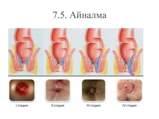 7.5. Айналма