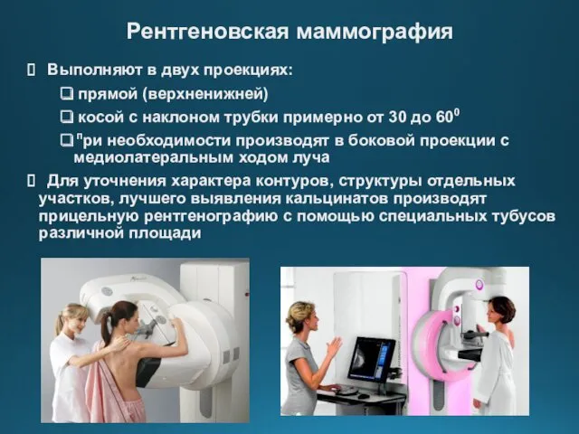 Рентгеновская маммография Выполняют в двух проекциях: прямой (верхненижней) косой с