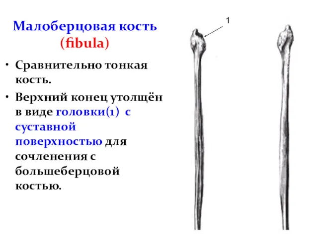 Малоберцовая кость (fibula) Сравнительно тонкая кость. Верхний конец утолщён в