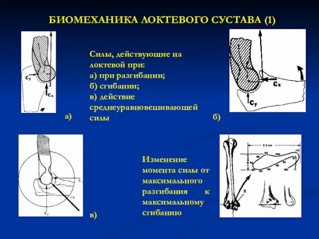 БИОМЕХАНИКА ЛОКТЕВОГО СУСТАВА (1) Силы, действующие на локтевой при: а)