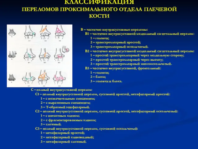 КЛАССИФИКАЦИЯ ПЕРЕЛОМОВ ПРОКСИМАЛЬНОГО ОТДЕЛА ПЛЕЧЕВОЙ КОСТИ В – частично внутрисуставные