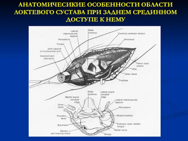 АНАТОМИЧЕСИКИЕ ОСОБЕННОСТИ ОБЛАСТИ ЛОКТЕВОГО СУСТАВА ПРИ ЗАДНЕМ СРЕДИННОМ ДОСТУПЕ К НЕМУ