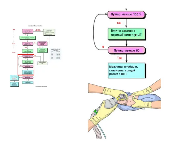 Так Ні Так Пульс менше 100 ? Пульс менше 60 ? Вжити заходи