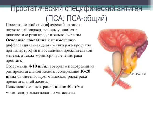 Простатический специфический антиген (ПСА; ПСА-общий) Простатический специфический антиген - опухолевый