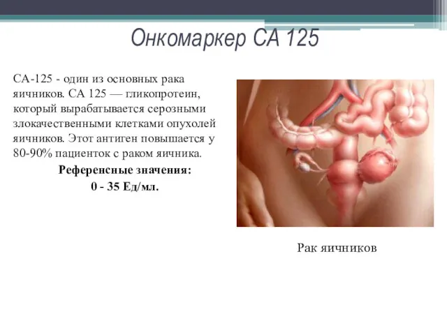 Онкомаркер CA 125 CA-125 - один из основных рака яичников.