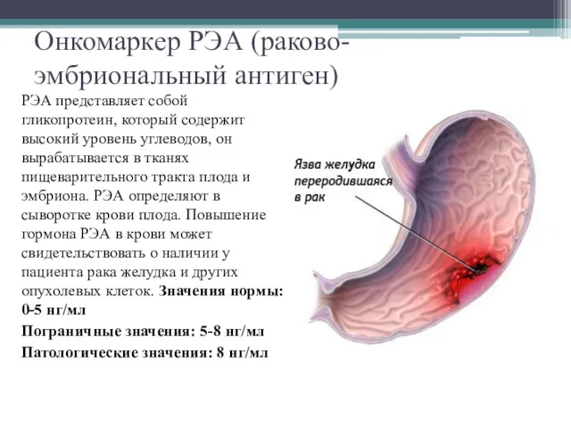 Онкомаркер РЭА (раково-эмбриональный антиген) РЭА представляет собой гликопротеин, который содержит