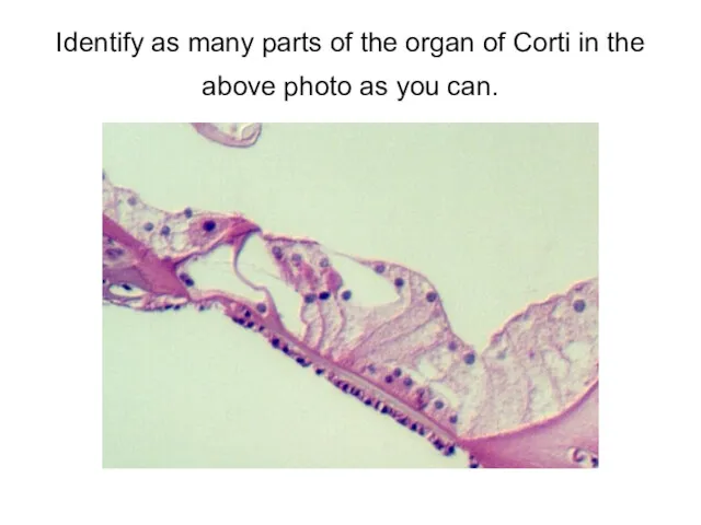 Identify as many parts of the organ of Corti in the above photo as you can.