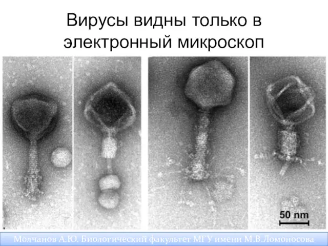 Вирусы видны только в электронный микроскоп Молчанов А.Ю. Биологический факультет МГУ имени М.В.Ломоносова