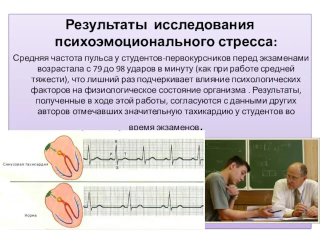 Результаты исследования психоэмоционального стресса: Средняя частота пульса у студентов-первокурсников перед