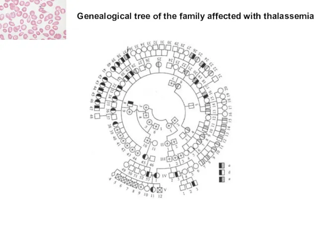 Genealogical tree of the family affected with thalassemia