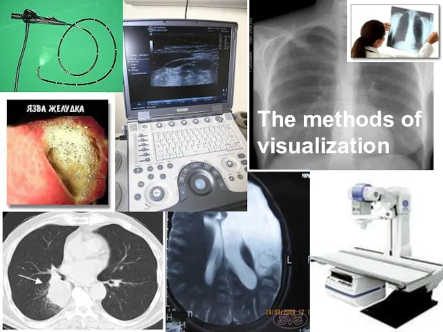 Методы визуализации The methods of visualization