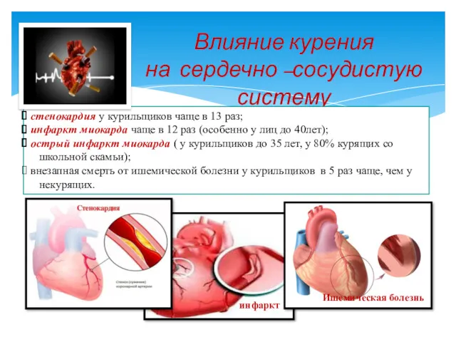 Влияние курения на сердечно –сосудистую систему стенокардия у курильщиков чаще